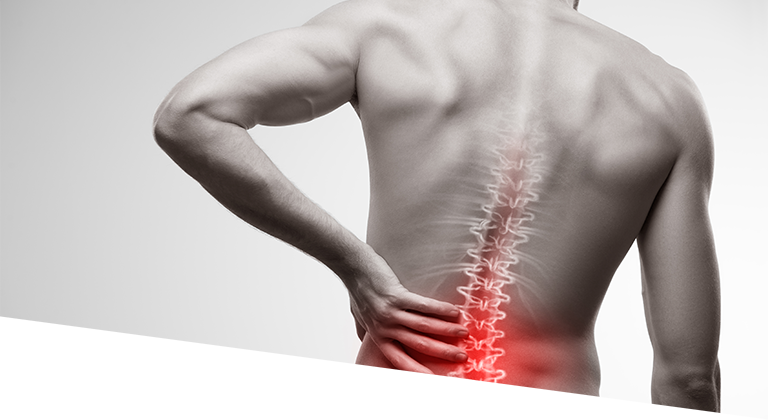 A man's back with spinal joints depicted while he clutches his low back in pain