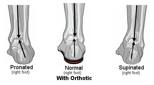 Orthotic Diagram