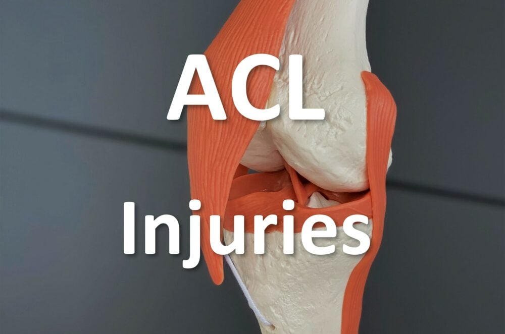 close up of anatomical model of ACL in the knee