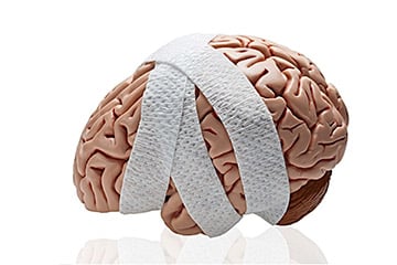 post concussion syndrome brain damaged and treated with bandage