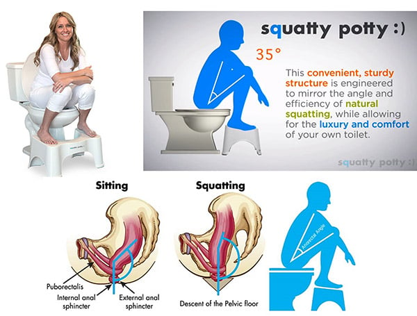 woman sitting on toilet squatty potty for helping treat constipation